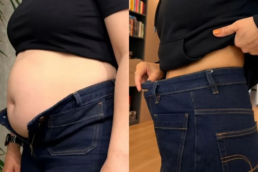Antes e depois de paciente no acompanhamento de emagrecimento, caso 3