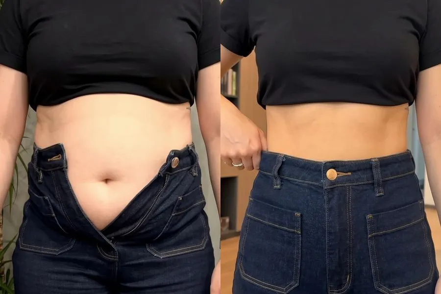 Antes e depois de paciente no acompanhamento de emagrecimento, caso 4